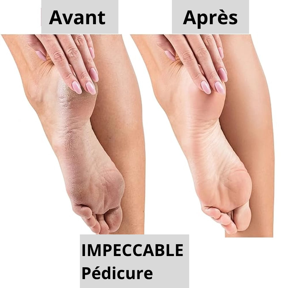 Limeuse de paume de pied électrique