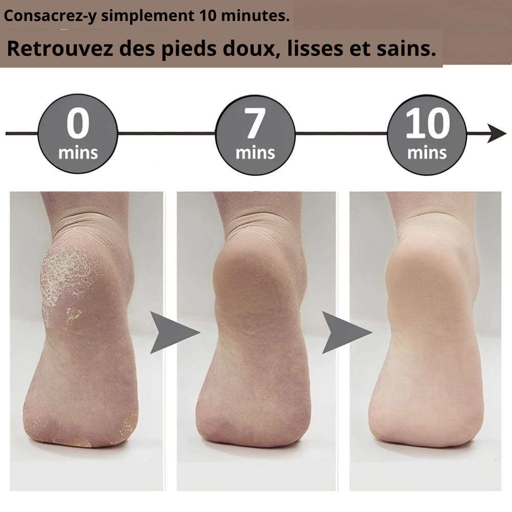 Limeuse de paume de pied électrique