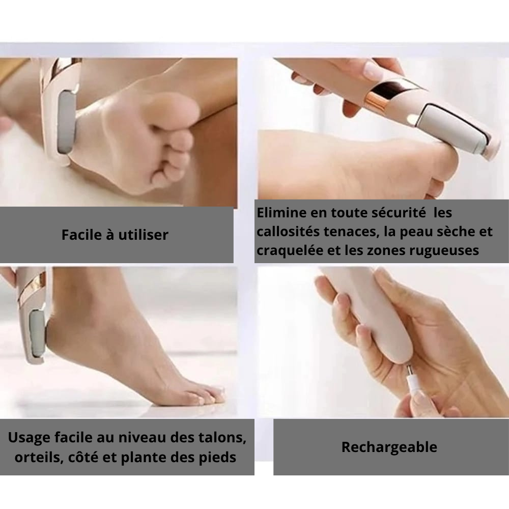 Limeuse de paume de pied électrique