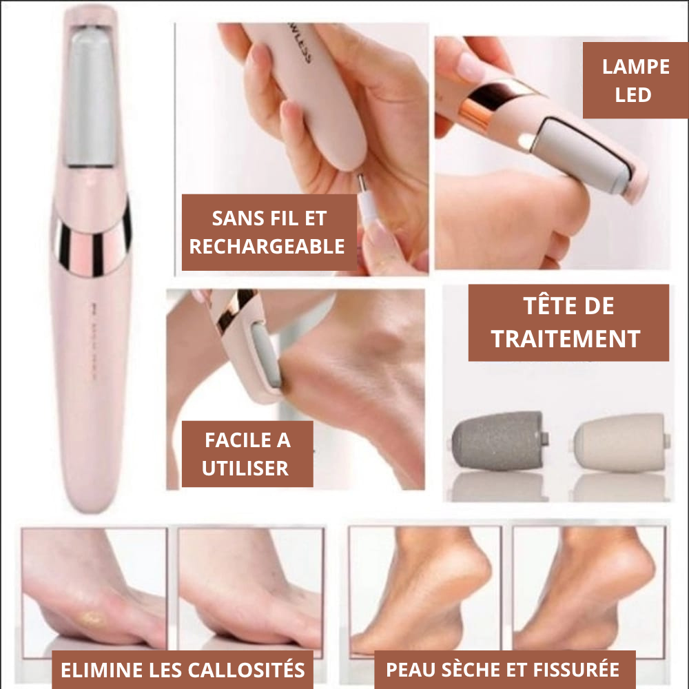 Limeuse de paume de pied électrique